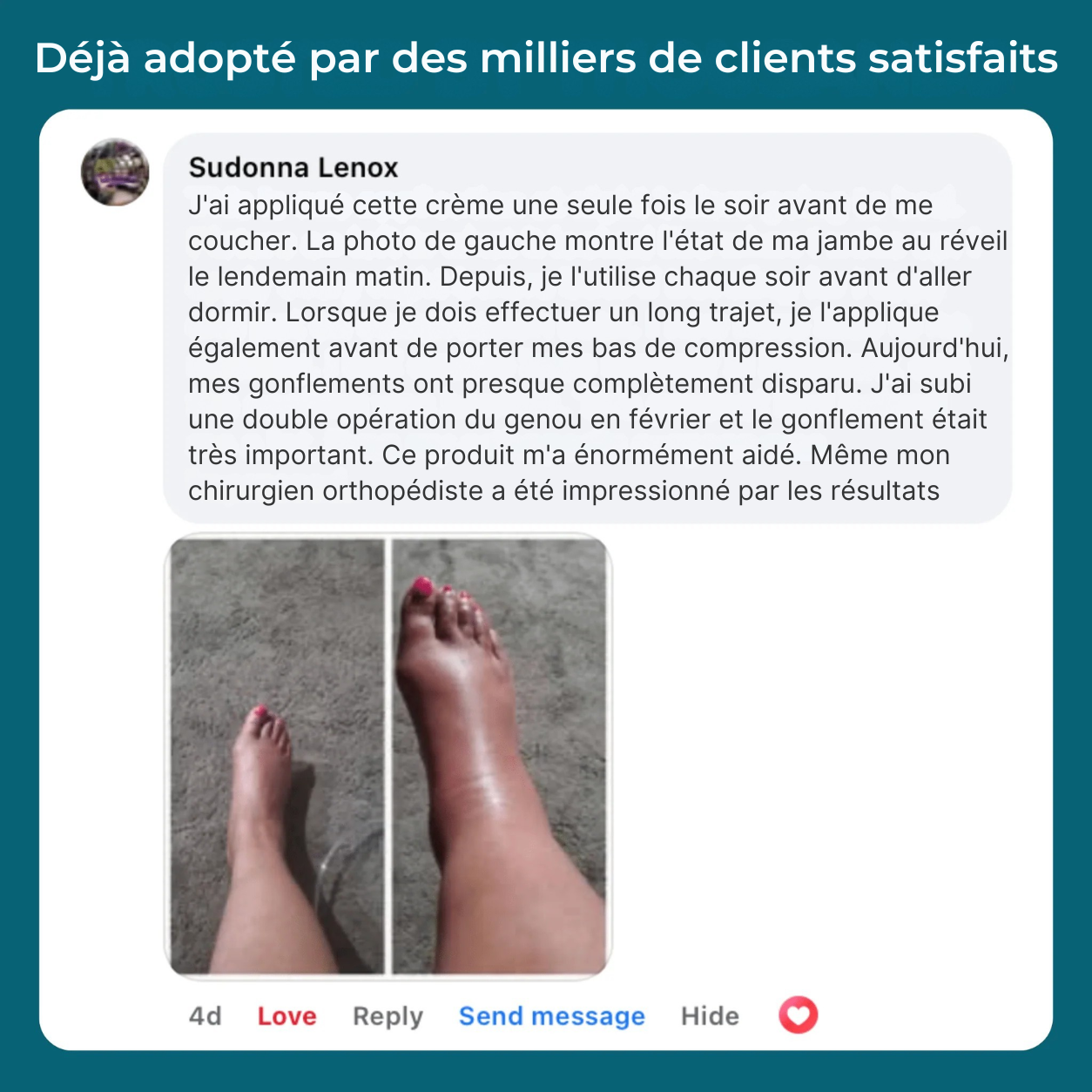 Gel de massage corporel hydratant aux ingrédients à base de plantes