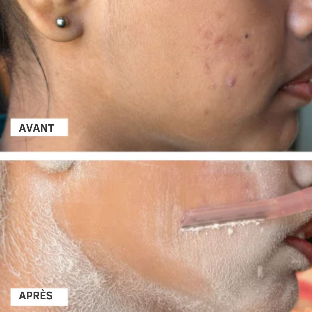 🔥 LE SECRET D’UNE PEAU